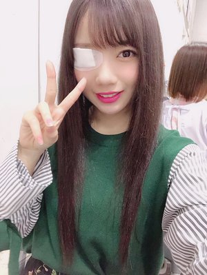 眼帯を取った時にまた - 画像1