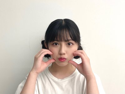 友人の猫をハムハムしたら猫アレルギーが発覚したワタナベ🐈 - 画像2