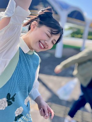 私のおでこにホクロあるの知ってるよ〜って方🖐🏻 - 画像2