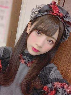 階段登るときはつま先しかつけないんですが、みなさんはつま先で登りますか？ - 画像2