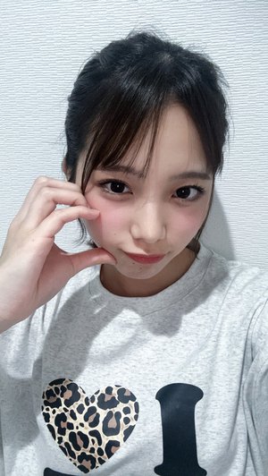 蝉が頭に乗ってきた、、 下田衣珠季
