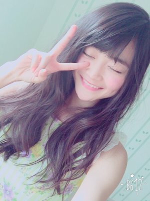 ハゲてる。。。 - 画像2
