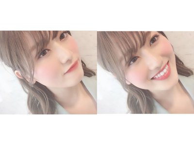 🍇💕👀 - 画像2
