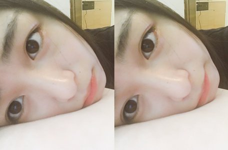 林檎、146のサムネイル