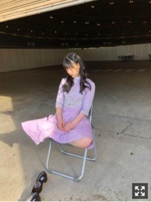 登校中に蚊に3箇所刺れたの。しかも全部左腕肘より下。 - 画像4