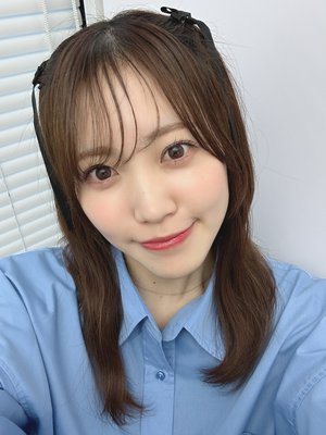 #393 コンタクトの悩み - 画像2